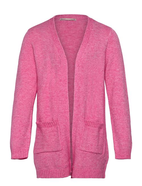 Se Kids Only Koglesly L/S Open Cardigan Knt Noos Kids Only Pink ved Booztlet