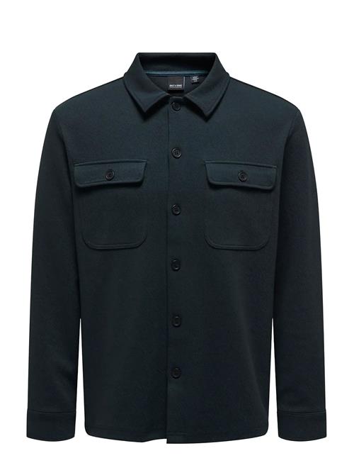 ONLY & SONS | Onsnewkodyl Overshirt Sweat Noos | M