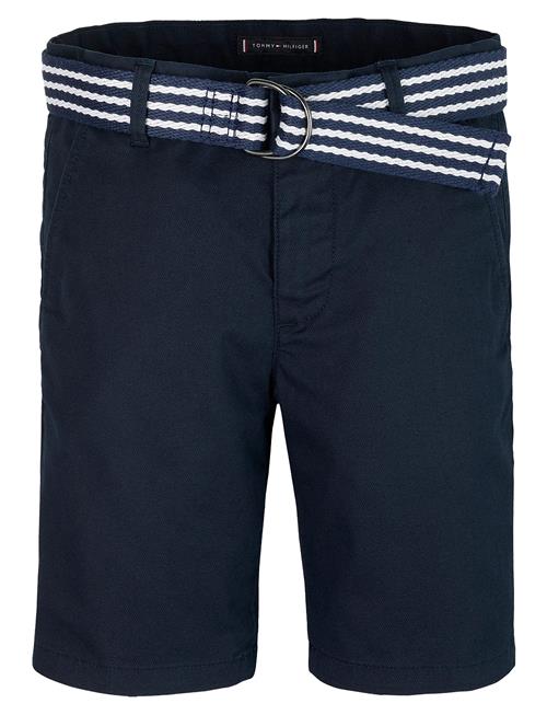 Tommy Hilfiger | Woven Belted Short | 140