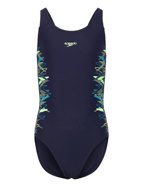 Speedo | Placement Muscleback One Piece | 164