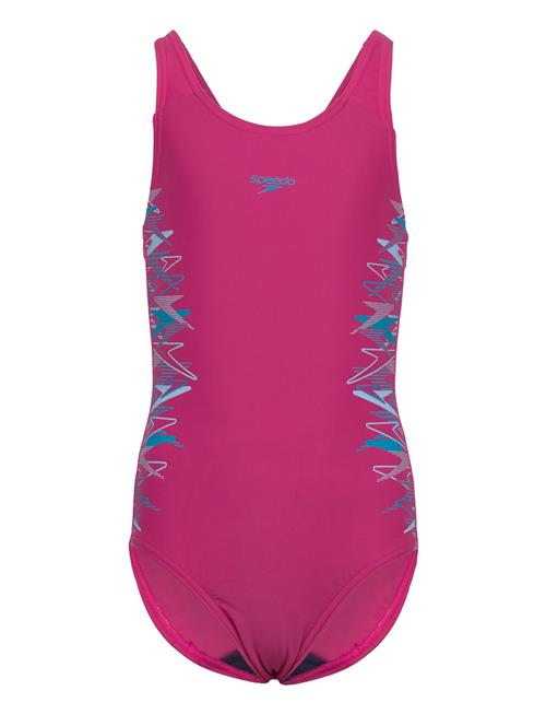 Speedo | Placement Muscleback One Piece | 128