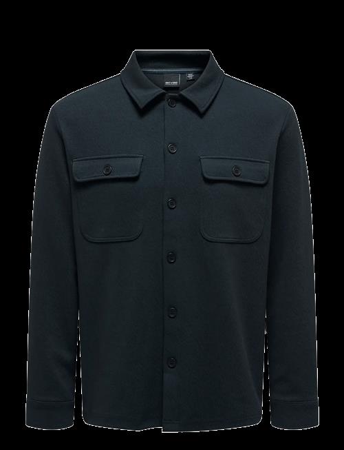 ONLY & SONS | Onsnewkodyl Overshirt Sweat Noos | XL