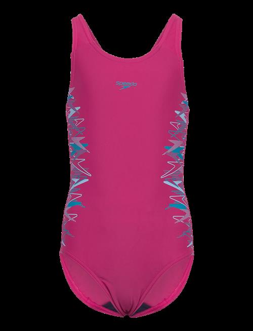 Speedo | Placement Muscleback One Piece | 164