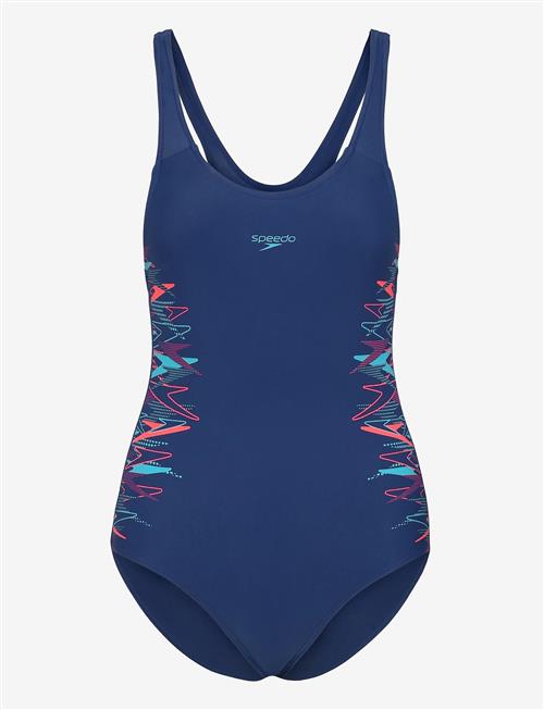 Speedo | Placement Muscleback 1Pc | 140